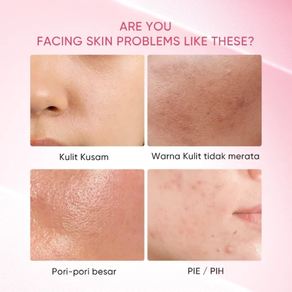 SKINTIFIC - Niacinamide Bright Boost Clay Stick 40g | Brightening Glowing Masker Wajah Komedo Skincare BPOM Eksfoliasi Wajah Exfoliating Pengangkat Komedo Penghilang Jerawat BPOM Acne Mask with DSM High-Purity Niacinamide Arbutin Pink Sea Sa - Image 7