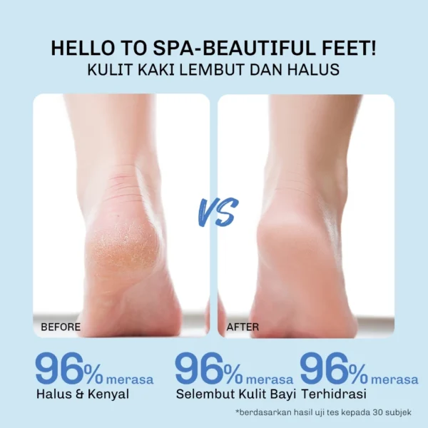 LVJ lavojoy Baby Feet Get Foot Mask Feel My Rhythm | Masker Kaki untuk Melembabkan dan mencerahkan| Penghalus Tumit Kaki - Image 5