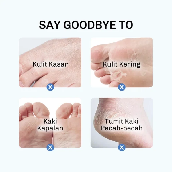 LVJ lavojoy Baby Feet Get Foot Mask Feel My Rhythm | Masker Kaki untuk Melembabkan dan mencerahkan| Penghalus Tumit Kaki - Image 8